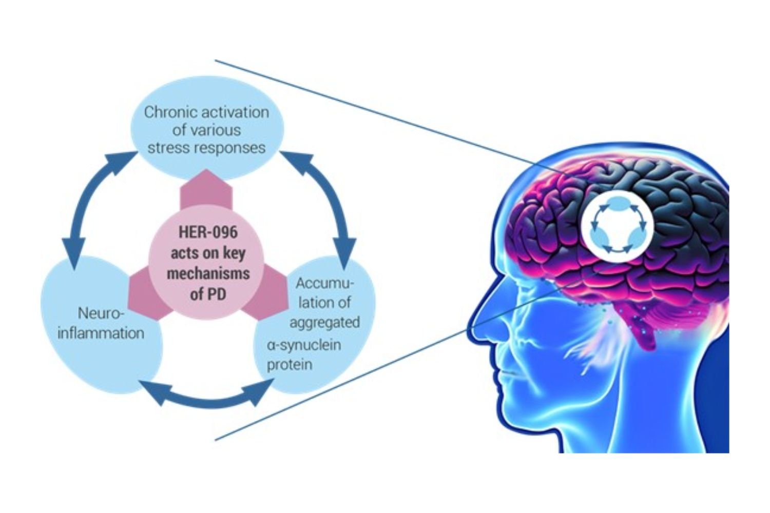 Stop Parkinson steunt baanbrekend onderzoek naar nieuwe behandeling voor parkinson